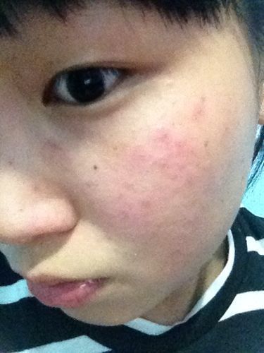 甲醛超標小孩有何反應(yīng)
